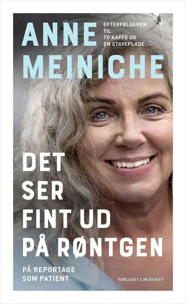 Det ser fint ud på røntgen